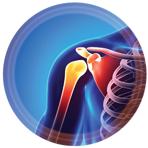 Treatment options for shoulder instability