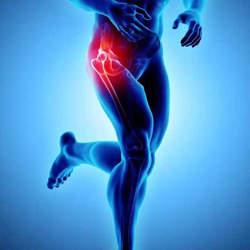 Hip replacement surgery Perth.