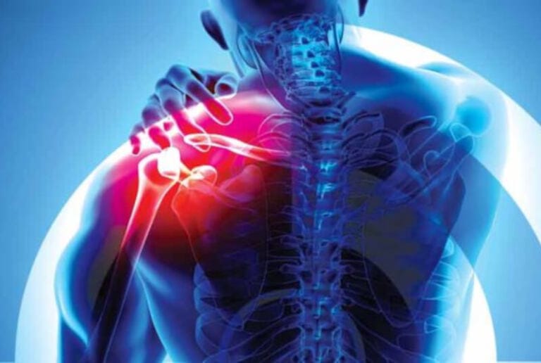 Shoulder surgery Perth.